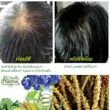 ภาพขนาดย่อของภาพหน้าปกสินค้าHair fall hair thinning dandruff grizzled "shampoo stud Thai head ิร์ Cam" (volume 250ml.) formula crispa  + pro-vitamin จากร้าน Phanthaiherb บน Lazada ภาพที่ 2