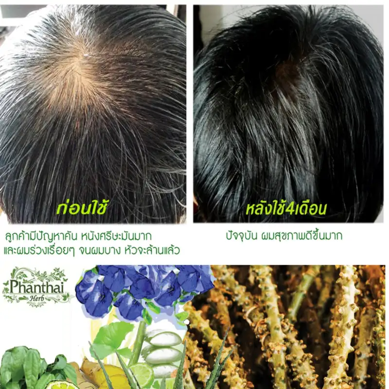 ภาพสินค้าHair fall hair thinning dandruff grizzled "shampoo stud Thai head ิร์ Cam" (volume 250ml.) formula crispa  + pro-vitamin จากร้าน Phanthaiherb บน Lazada ภาพที่ 2