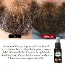 ภาพขนาดย่อของภาพหน้าปกสินค้าEELHOE (genuine company) eyebrow growth serum eyebrow growth liquid hair growth liquid hair growth liquid hair growth liquid milliliter. จากร้าน Skin expert บน Lazada ภาพที่ 15