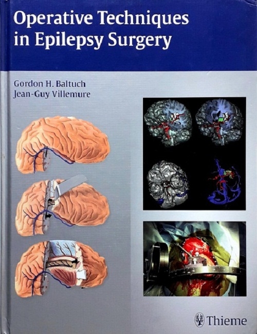 OPERATIVE TECHNIQUES IN EPILEPSY SURGERY (HARDCOVER)  Author: Gordon H. Baltuch  Ed/Yr: 1/2009 ISBN: 9781604060300