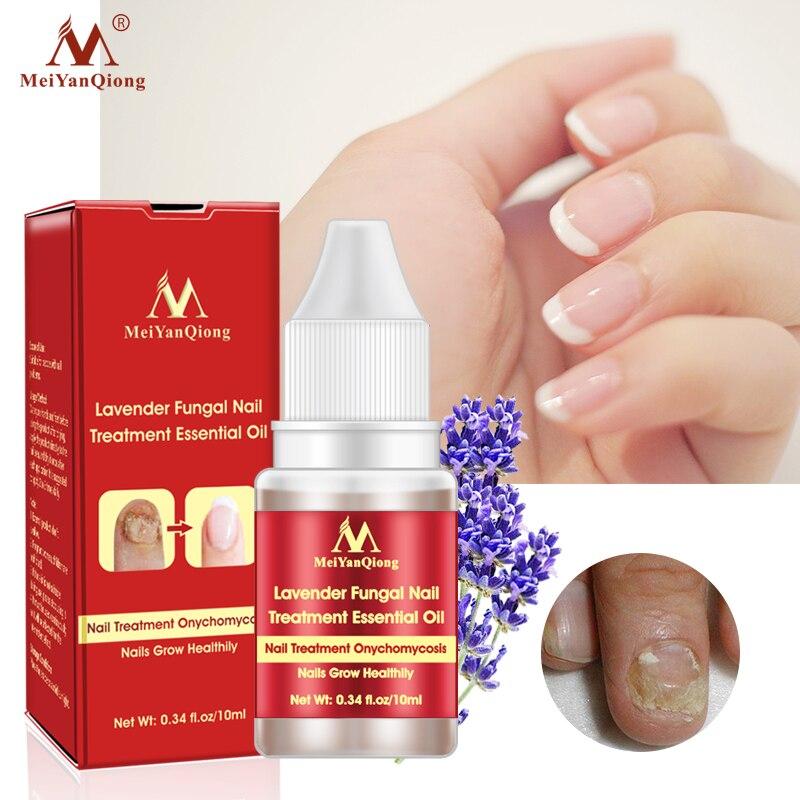 [ยิ่งซื้อ ยิ่งลด]MeiYanQiong 10ml เซรั่มรักษาเล็บ เซรั่มซ่อมเซมเล็บ เอ็สเซ้นซ่อมแซมเล็บ Lavender Fungal Nail Treatment Essential Oil Nail Art & Tools Promote Nails Grow Healthy Nail Treatment Onychomycosis Foot Care