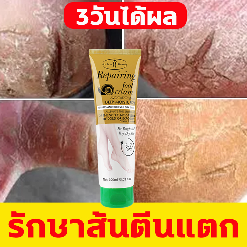 Aichun เซรั่มลบรอยแผลเป็น，กำจัดแผลเป็นมีประสิทธิภาพในการปรับปรุงสถานะแผลเป็น（ครีมลบรอยแผลเป็น