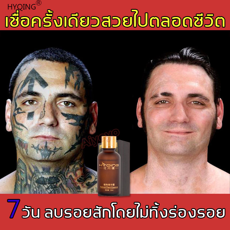 [100%ลบรอยสักอย่างรวดเร็ว] HUAYUEQING ครีมลบรอยสัก เครื่องลบรอยสัก 30ml ลบรอยสักอย่างรวดเร็ว ไม่เจ็บ ( ลบรอยสักถาวร ครึมลบรอยสัก น้ำยาลบรอยสัก ครีมลบลอยสัก ล้างรอยสักคิ้วโ ครีมลบลอยสัก ครีมปิดรอยสัก ที่ลบรอยสัก ลบรอยแผลเปน Tattoo Removal Cream )