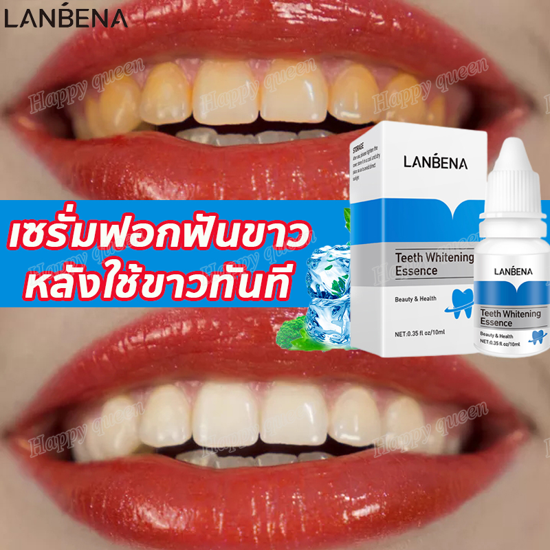 LANBENA ฟันขาว เซรั่มฟอกฟันขาว ทำความสะอาดฟัน ทำความสะอาดช่องปาก ฟอกฟันขาว ที่ฟอกฟันขาว   น้ำยาฟอกฟันขาว ฟันขาว ที่ทำให้ฟันขาว น้ำยาฟันขาว น้ำยาฟันฟันขาว ช่องปาก ฟันขาวของแท้ ฟอกสีฟัน  แก้ฟันดำ ฟันเหลือง Teeth Whitening Liquid
