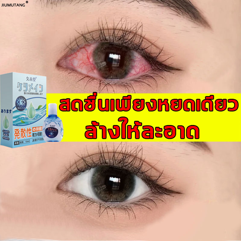 JIUMUTANG  น้ำยาหยอดตา สารสกัดจากพืชเพื่อเพิ่มความชุ่มชื้นให้กับดวงตาและปกป้องสายตา แก้ตาแห้ง ตาแดง ตาเมื่อยล้า อาการคันตา ความรู้สึกไม่สบาย ฯลฯ（ น้ำยาหยอดตา    ยาหยอดตา  Eye drop น้ำยาล้างตา
