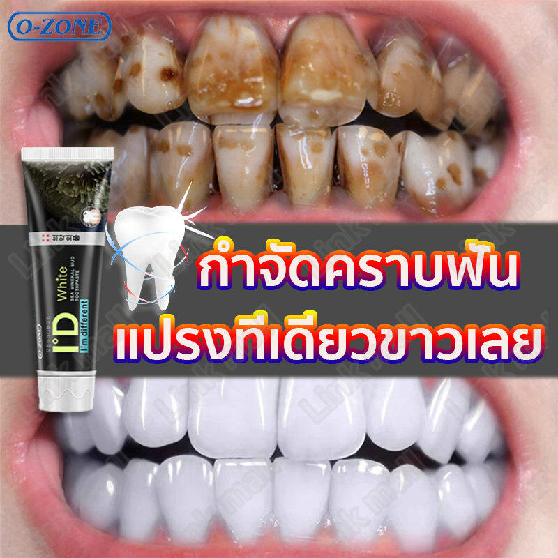ฟันยิ่งสกปรกก็ยิ่งมีประสิทธิภาพ！【นำ​เข้า​จาก​เกาหลี​】O-ZONE ยาสีฟัน ฟันสวย,ฟันขาว,ฟอกฟันขาว กำจัดกลิ่นปาก ต้านเชื้อแบคทีเรียและกำจัดคราบฟัน,แก้ฟันเหลือง(ยาสีฟันฟันขาว,ยาสีฟันฟอกขาว,ยาฟอกฟันขาว,ยาสีฟันฟอกฟันขาว,ยาสีฟันขจัดหิน,เซรั่มฟอกฟันขาว,ฟอกสีฟัน)