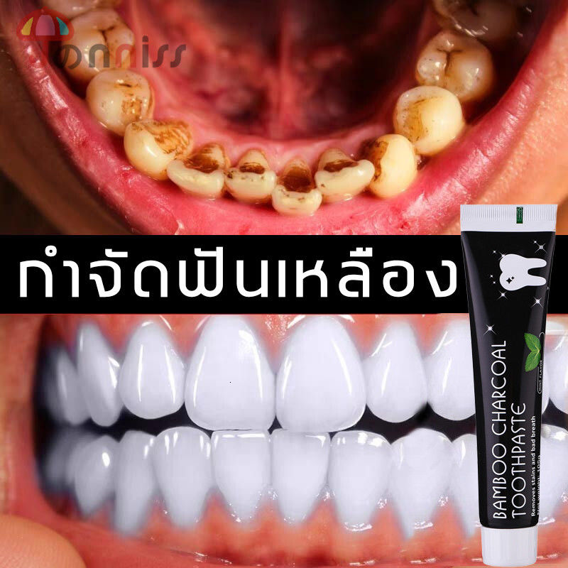 ฟันขาว ยาสีฟันขจัดหิน ยาสีฟันฟอกขาว toothpaste ดูแลสุขภาพฟัน ขจัดฟันเหลืองฟันดำดับกลิ่นปากช่วยให้ฟันขาว