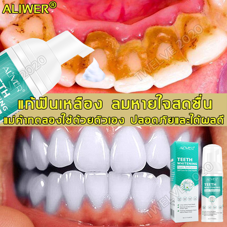 ALIWER น้ำยาฟอกฟันขาว 60ml ดูแลช่องปาก ลมหายใจสดชื่น เหมาะสำหรับทุกคน (ฟอกฟันขาว ยาฟอกฟันขาว มูสแปรงฟันขาว น้ำยาขัดฟันขาว ยาสีฟันฟันขาว ฟอกฟันขาวแท้ น้ำยาฟันขาว มูสฟอกสีฟัน ยาสีฟัน ครีมฟอกฟันขาว น้ำยาฟอกฟัน ฟอกสีฟันขาว ยาขัดฟันขาว มูสแปรงฟัน)