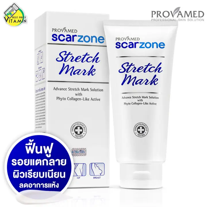 scar zone stretch mark