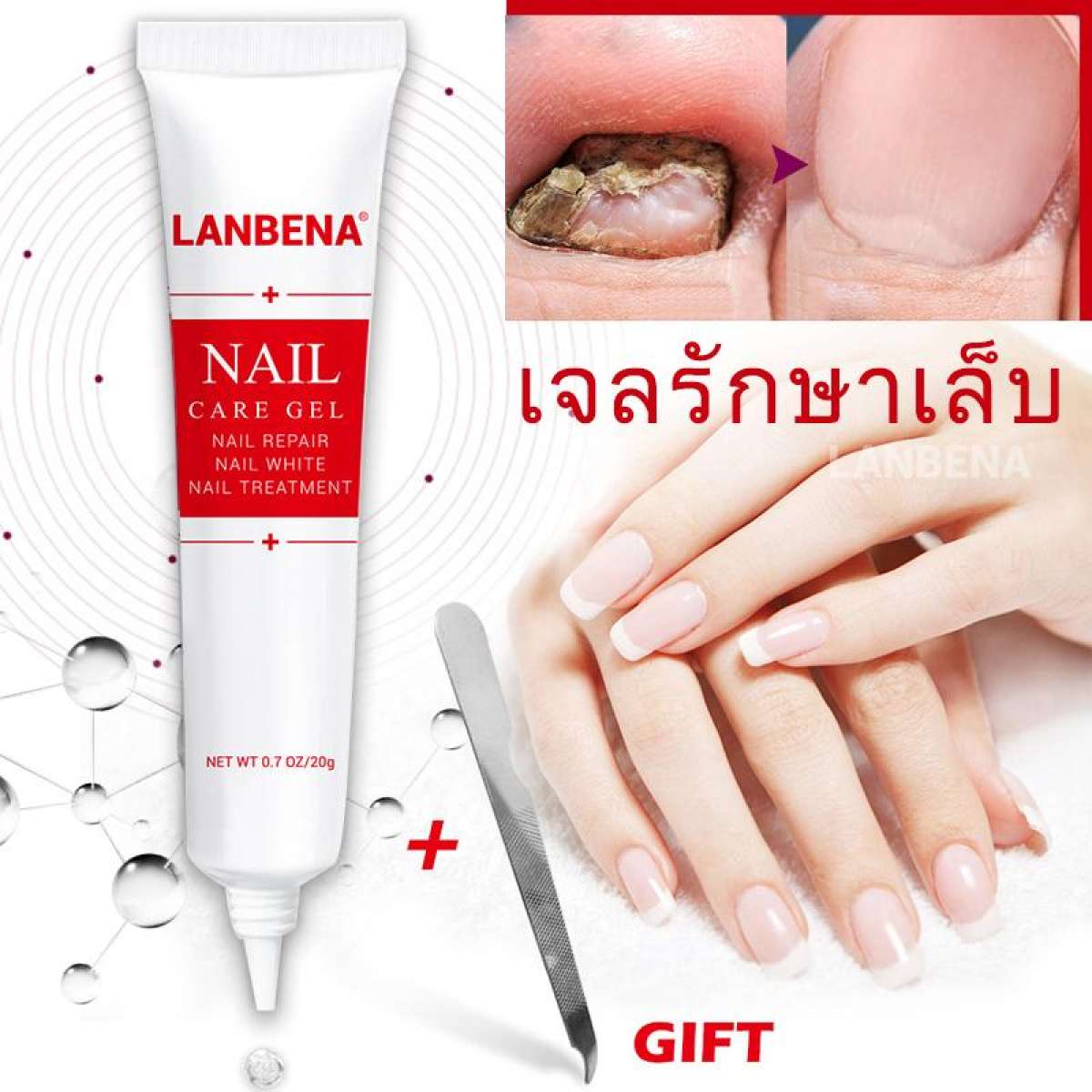 LANBENA เจลรักษาเล็บ ลบเชื้อราเล็บ บำรุงผิว รักษาอาการปวด ใช้ได้มือและเท้าNail Care Gel Fungal Nail Treatment Remove Onychomycosis Nail Care Hand And Foot Care(Hot Deal)