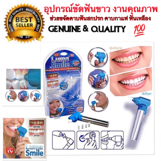 เครื่องขัดฟัน luma smile ที่ขัดฟัน ที่ขัดฟันไฟฟ้า อุปกรณ์ขัดฟัน Luma Smile Rubber Head Tooth Polisher for Teeth Whitening Burnisher Polisher Whitener Stain Remover