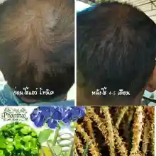 ภาพขนาดย่อของภาพหน้าปกสินค้าHair fall hair thinning dandruff grizzled "shampoo stud Thai head ิร์ Cam" (volume 250ml.) formula crispa  + pro-vitamin จากร้าน Phanthaiherb บน Lazada ภาพที่ 3
