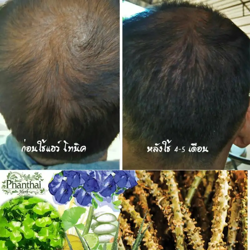 ภาพสินค้าHair fall hair thinning dandruff grizzled "shampoo stud Thai head ิร์ Cam" (volume 250ml.) formula crispa  + pro-vitamin จากร้าน Phanthaiherb บน Lazada ภาพที่ 3