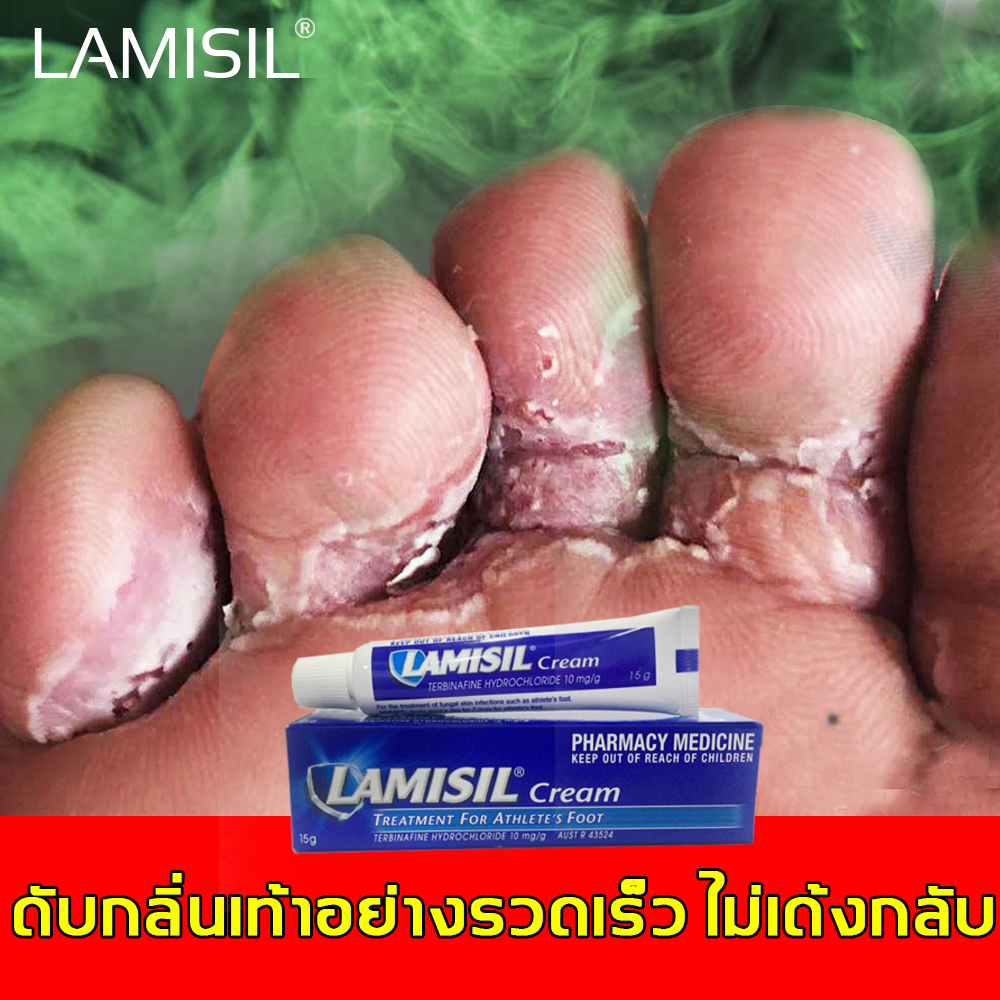 【รับรองของแท้100%】Lamisi ครีมติดเชื้อรา,ครีมลดกลิ่นเท้า กำจัดกลิ่นเท้า รักษาอาการคัน (ครีมระงับกลิ่นเท้า,ครีมเหน็บชา,ผลิตภัณฑ์ระงับกลิ่นเท้า,ครีมทาเท้าแตก,ระงับกลิ่นเท้า,กำจัดกลิ่นเท้า,)ดับกลิ่นเท้า,ยาแก้เท้าเหม็น,Beriberi/Foot odor