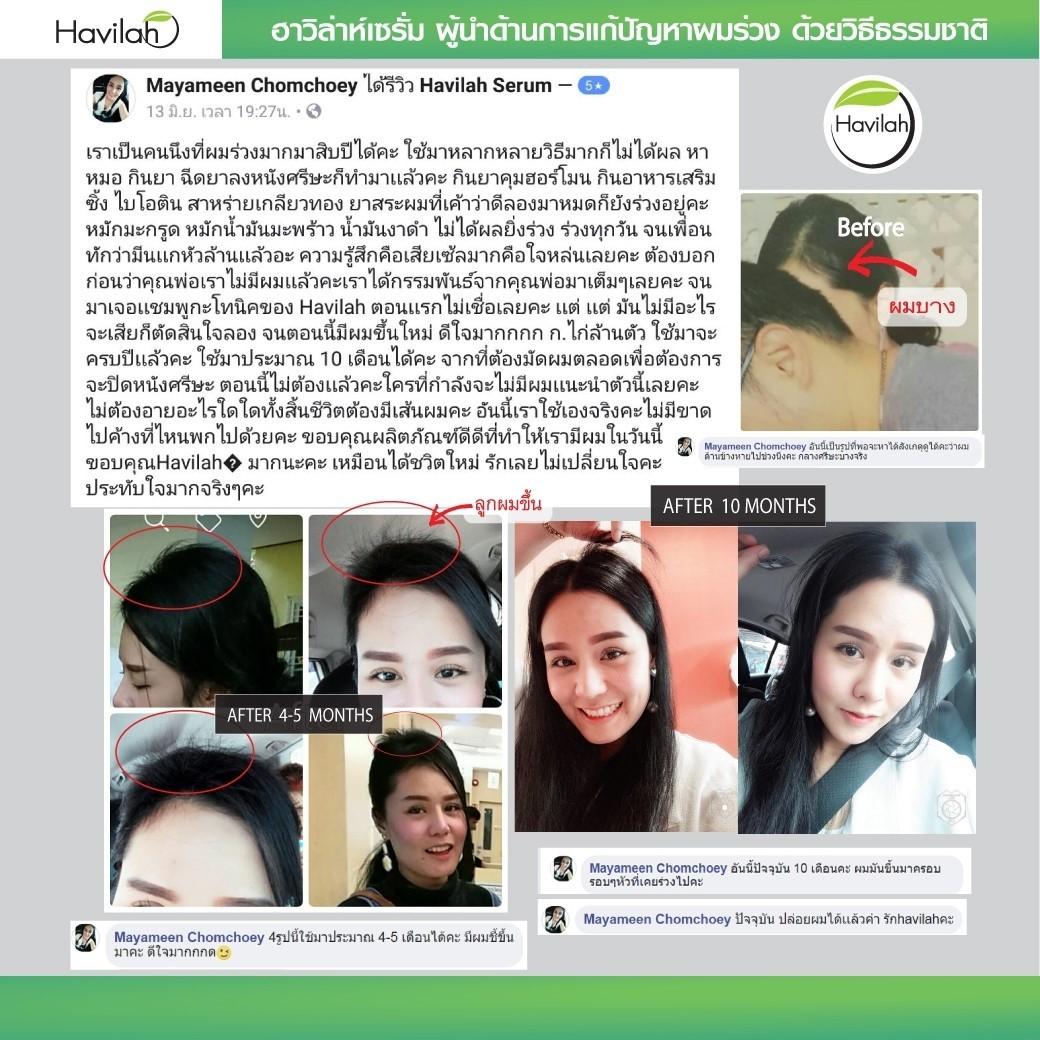 My Image 10