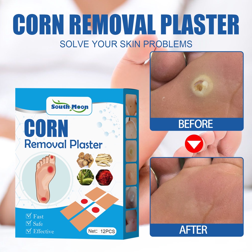 12แผ่นกล่อง Corn Wart Remover Plaster Canopy Patch Plaster Corn Removal ...