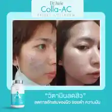 ภาพขนาดย่อของภาพหน้าปกสินค้าColla Ac Dietary Sment Product (Dr.Awie Brand) 3 bottle จากร้าน Dr.Awie x The Na  บน Lazada ภาพที่ 6