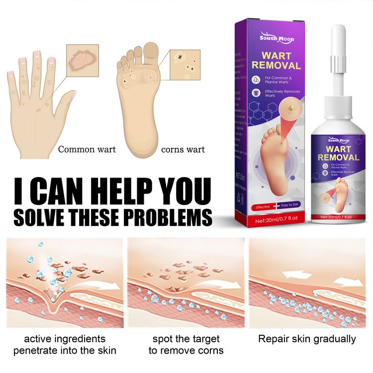 Clear Corn Removal Skin Care for Chicken Cocoons Calluses Foot Pads ...