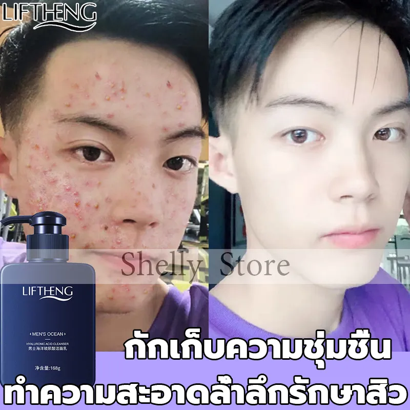 (โฟมล้างหน้า กำจัดสิว)🎉168g โฟมล้างหน้าสำหรับคนเป็นสิว โฟมล้างหน้าสำหรับคนหน้ามัน โฟมล้างหน้าสำหรับผิวแพ้ง่าย ทำความสะอาดผิวหน้าอย่างหมดจด โฟมล้างหน้า โฟมล้างหน้าสิว คลีนเซอร์ ไม่แน่นหลังล้าง เหมาะสำหรับรูขุมขนกว้าง จมูกดำ ผิวเป็นสิว ผิวมัน ปรับปรุงสิ