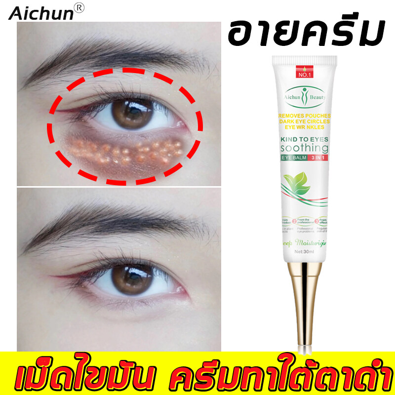 Aichun ครีมรอบดวงตา 30G อายครีม สามารถลดถุงใต้ตา ขอบตาดำ แบ่งเบาริ้วรอย ลดใต้ตาดำ  ครีมลดใต้ตาดํา อายครีมบำรุงตา ครีมลดถุงใต้ตา ครีมตาขอบตาดำ ครีมทาใต้ตา ครีมบำรุงรอบดวงตา  อายเจล ครีมทารอบดวงตา ครีมทาใต้ตาดำ ครีมบำรุงใต้ตา Eye Cream - Be A Shining  Girl ...