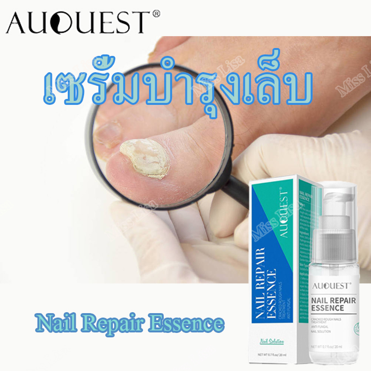 AuQuest เซรั่มรักษาเล็บ น้ำมันบำรุงเล็บ 20ml กำจัดเชื้อราที่เล็บ รักษาเล็บขบ เล็บหนา เล็บเปราะ เล็บไม่เรียบ เล็บแตก ฯลฯ บำรุงเล็บให้สวย รักษาเล็บ ดูแลเล็บ ซ่อมแซมเล็บ Fungal Nail Treatment Remove Onychomycosis