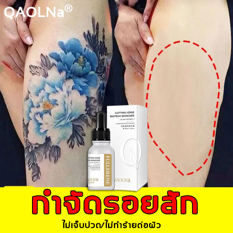 QAOLNa ครีมลบรอยสัก.30ml ยาลบรอยสัก ลบรอยสักอย่างรวดเร็ว น้ำยาลบรอยสัก อ่อนโยนและไม่เจ็บปวดโดยไม่ทิ้งรอยแผลเป็น.เครื่องลบรอยสัก ที่ลบรอยสัก ลบรอยสักถาวร น้ำยาลบลอยสัก ยาลบรอยสักคิ้ว ครีมปิดรอยสัก ครีมกำจัดรอยสัก เลเซอร์ลบรอยสัก