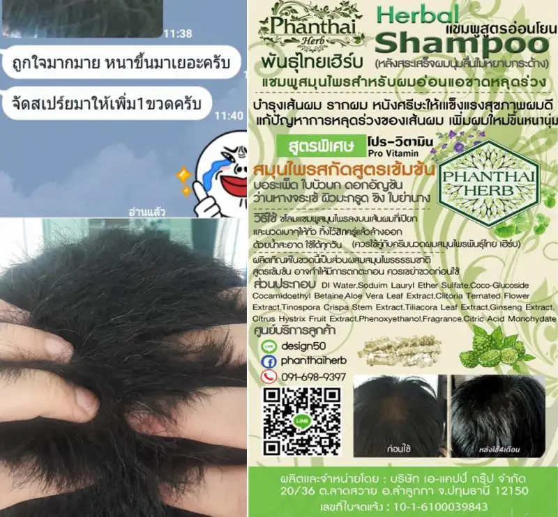 ภาพสินค้าHair fall hair thinning dandruff grizzled "shampoo stud Thai head ิร์ Cam" (volume 250ml.) formula crispa  + pro-vitamin จากร้าน Phanthaiherb บน Lazada ภาพที่ 7
