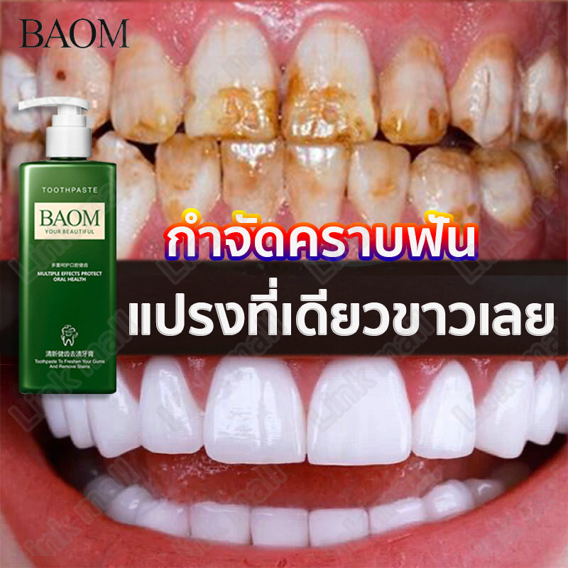 BAOM ยาสีฟันไวท์เทนนิ่ง ยาสีฟัน ฟอกฟันขาว ขจับครบเหลืองลดกลิ่นปาก ลดครบหินปูน ฟันเหลือง ยาสีฟันกำจัดคราบฟ ยาสีฟันฟันขาว Freshen Gums And Remove Stains 250g