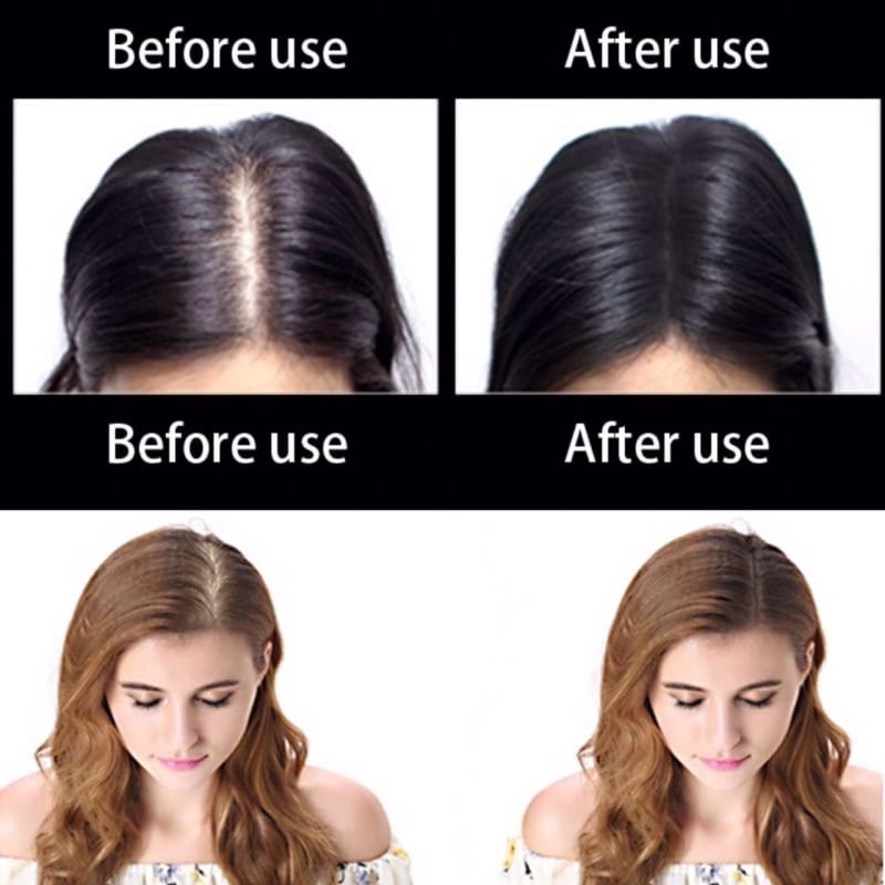 ⏩⏩ส่งฟรี เก็บเงินปลายทาง [Free Shipping] Toppik Hair ผงไฟเบอร์เพิ่มผม