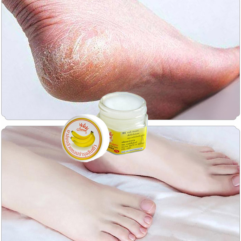 Hand Foot Crack Cream Anti Dry Chapped Cream Dry Skin Heel Chapped ...