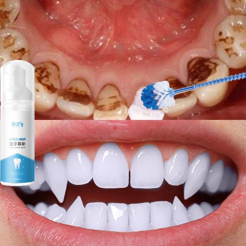 ยาสีฟัน มูสแปรงฟัน ยาสีฟันฟันขาว ฟอกฟันขาว บำรุงฟัน แก้ฟันเหลือง Teeth Whitening Mousse Foam