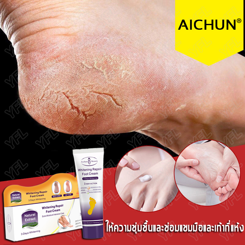 #พร้อมส่งจากไทย#Aichun ครีมทาเท้าแตก 100g แก้ไขปัญหาต่าง ๆ เช่นมือและเท้าที่แห้งแตก คัน เป็นขุย และผิวหยาบกร้าน ช่วยให้ผิวละเอียดอ่อนนุ่ม ดูแลเท้า,ครีมทาส้นเท้า,ครีมส้นเท้าแตก,ครีมบำรุงเท้า,ดูแลมือ,ครีมทาเท้า,ครีมทามือ Foot Cream