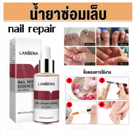 LANBENA เซรั่มรักษาเล็บ น้ำมันบำรุงเล็บ รักษาเล็บ เล็บขบ เชื้้อรา สมุนไพรรักษาเล็บขบ Fungal Nail Treatment Remove Onychomycosis Toe Nourishing Brighten Hand Foot Skin Care