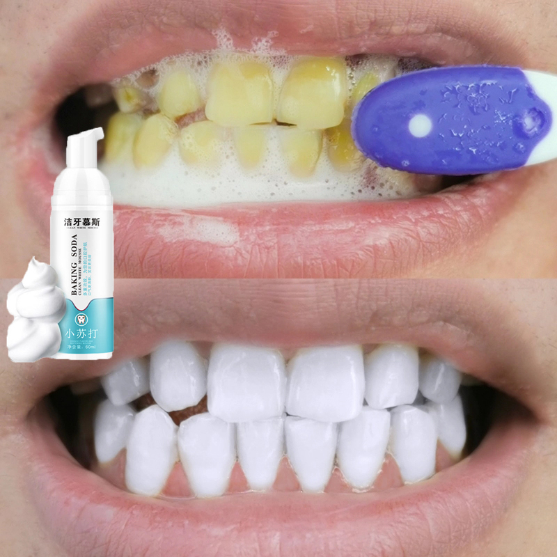 ยาสีฟันฟันขาว ยาสีฟัน ยาสีฟันขจัดปูน ฟอกฟันขาว บำรุงฟัน แก้ฟันเหลือง ดับกลิ่นปาก ฟอกฟันขาว ฟันขาว น้ำยาฟอกสีฟัน Teeth Whitening