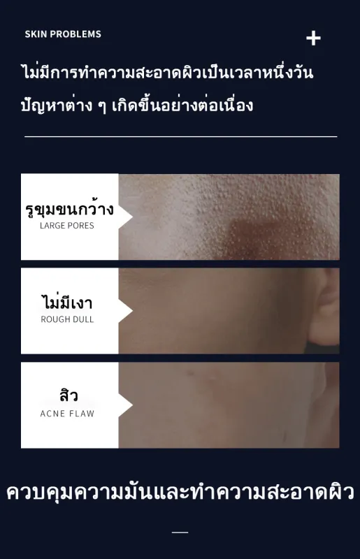 ภาพสินค้า(โฟมล้างหน้า กำจัดสิว) 168g โฟมล้างหน้าสำหรับคนเป็นสิว โฟมล้างหน้าสำหรับคนหน้ามัน โฟมล้างหน้าสำหรับผิวแพ้ง่าย ทำความสะอาดผิวหน้าอย่างหมดจด โฟมล้างหน้า โฟมล้างหน้าสิว คลีนเซอร์ ไม่แน่นหลังล้าง เหมาะสำหรับรูขุมขนกว้าง จมูกดำ ผิวเป็นสิว ผิวมัน ปรับปรุงสิ จากร้าน Joanna. บน Lazada ภาพที่ 4