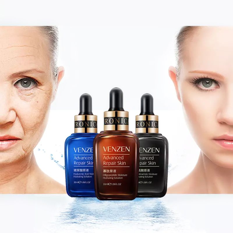 essence for hyperpigmentation