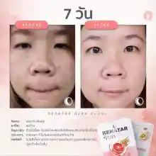 ภาพขนาดย่อของภาพหน้าปกสินค้าRENATAR AURA PLUS+  เรนาต้า ออร่า พลัส จากร้าน Bella Colla by Wora บน Lazada ภาพที่ 5