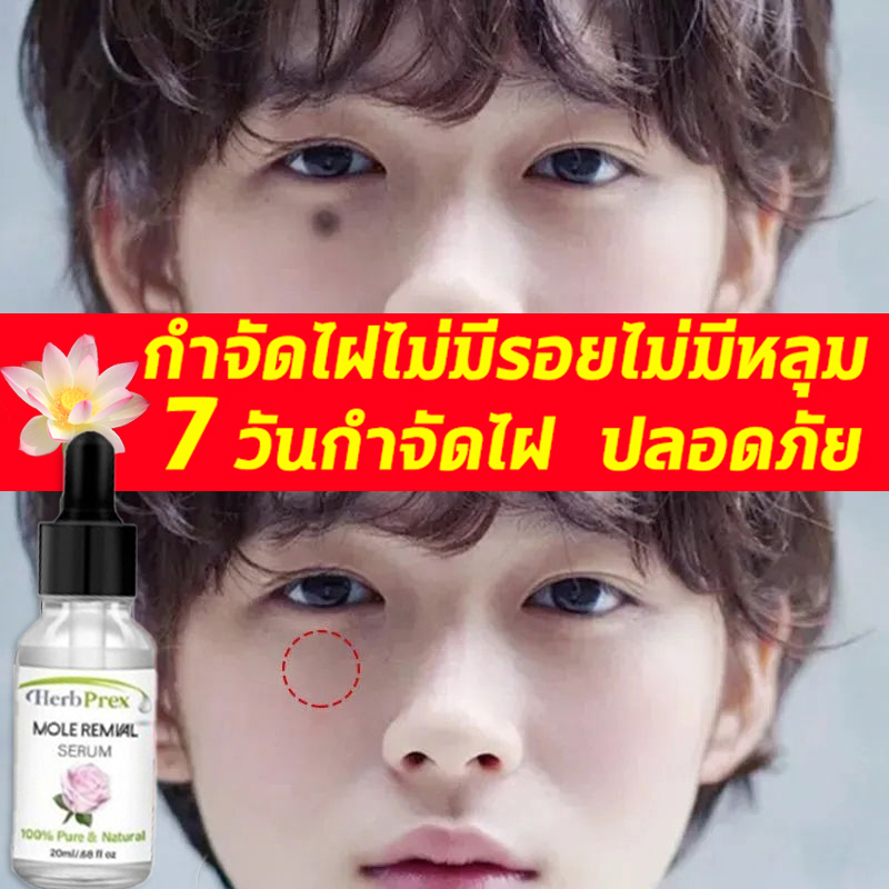 💝ปลอดภัยลดไฝเร็ว คืนผิวที่ไม่มีตำหนิให้คุณ💝Herb Prexครีมทาหูด(ทาจุดด่างดำ.กำจัดไฝ.ครีมจี้ไฝ.ครีมทาจี้ไฝ.ยาทาใฝ.ยาทาขี้แมลงวัน.น้ำยาจี้ไฝ.จี้ขี้แมลงวัน.ครีมทาติ่งเนื้อ.ครีมกำจัดติ่งเนื้อ.ครีมทาไฝ.ครีมกำจัดหูด.กำจัดติ่งเนื้อ .ครีมแต้มไฝ.ครีมไฝ.ครีมขจัดไฝ)