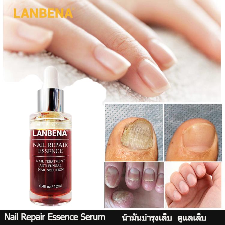 ราคา LANBENA Nail Repair Essence Serum น้ำมันบำรุงเล็บ ดูแลเล็บ รักษา