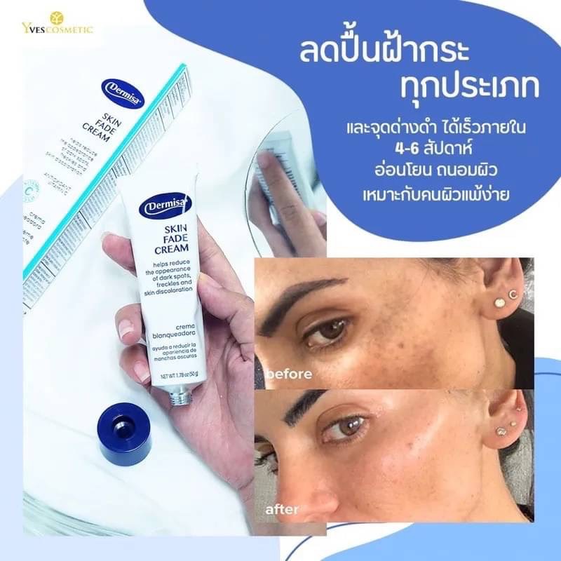 Mesmerizing Dermisa Skin Fade Cream Photo Illustration Mesmerizing Dermisa Skin Fade Cream Photo Illustration