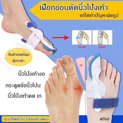 1 Pair Bunion Corrector Big Toe Night Splint Relief Hallux Valgus Foot Pain for Women Men