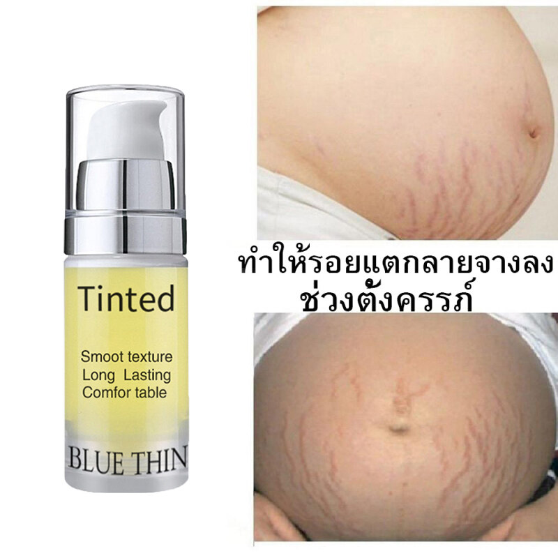 Bluethin????ครีมลดรอยแตกลาย ออยลดรอยแตกลาย ครีมทาแตกลาย ครีมลดลอยเเตก ครีม ทาขาแตกลาย ครีมทาท้องลาย ครีมท้องแตกลาย ครีมทาก้นดำลาย ครีมทาขาลาย ครีมทาผิว  ครีมทารอยแตก ลดผิวแตกลาย แก้แตกลาย ครีมลดลอยแตกลาย ครีมหน้าขาว Scar Removal  Cream - Wulala - Thaipick