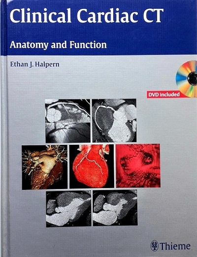 CLINICAL CARDIAC CT: ANATOMY AND FUNCTION (WITH CD-ROM) (HARDCOVER) Author: Ethan J. Halpern Ed/Yr: 1/2008 ISBN:9781588906182