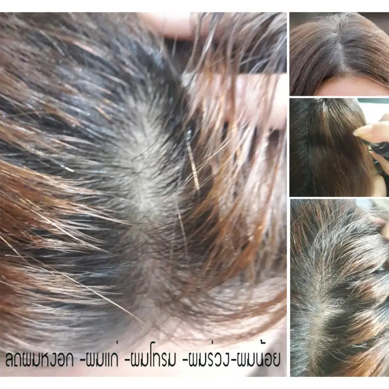 ภาพสินค้าHair fall hair thinning dandruff grizzled "shampoo stud Thai head ิร์ Cam" (volume 250ml.) formula crispa  + pro-vitamin จากร้าน Phanthaiherb บน Lazada ภาพที่ 4