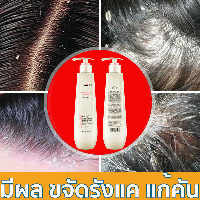 👉ส่งจากไทยค่ะ👈 YING-Z-SE 500ML แชมพูขจัดรังแค บรรเทาอาการคันหนังศีรษะ ...