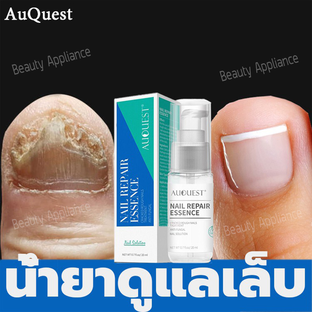 AuQuest เซรั่มรักษาเล็บ น้ำมันบำรุงเล็บ กำจัดเชื้อราที่เล็บ รักษาเล็บขบ เล็บหนา เล็บเปราะ เล็บไม่เรียบ เล็บแตก ฯลฯ บำรุงเล็บให้สวย รักษาเล็บ ดูแลเล็บ ซ่อมแซมเล็บ Fungal Nail Treatment Remove Onychomycosis