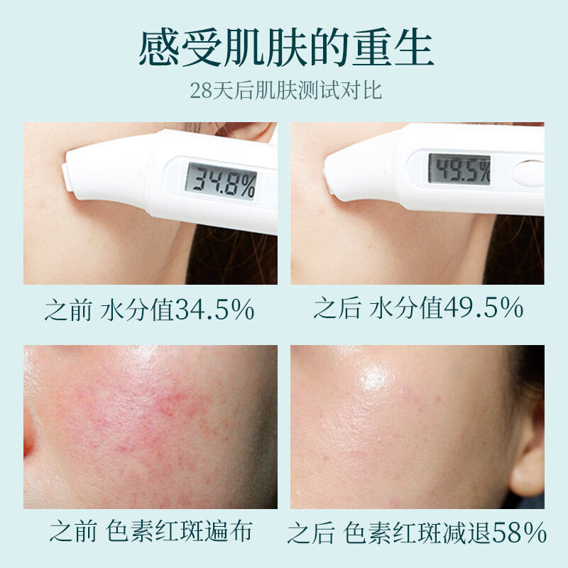 I Cosmetics Store แผ่นมาส์กหน้าสูตรพีช ที่มาร์คหน้าเกาหลี บำรุงผิวหน้า ให้ชุ่มชื้น 1แผ่น