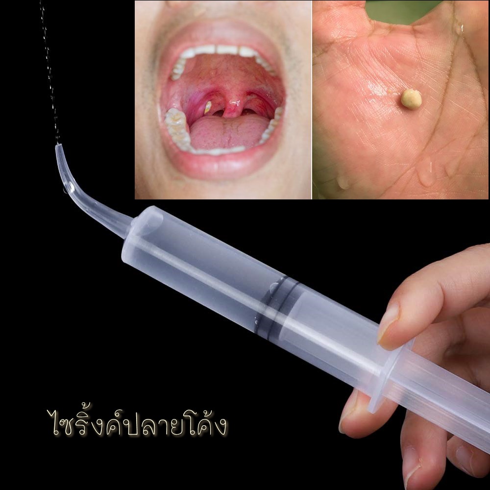 ไซริงค์ กำจัดนิ่วทอนซิล tonsil stone ไซริ้งค์ปลายโค้ง Dental irrigation