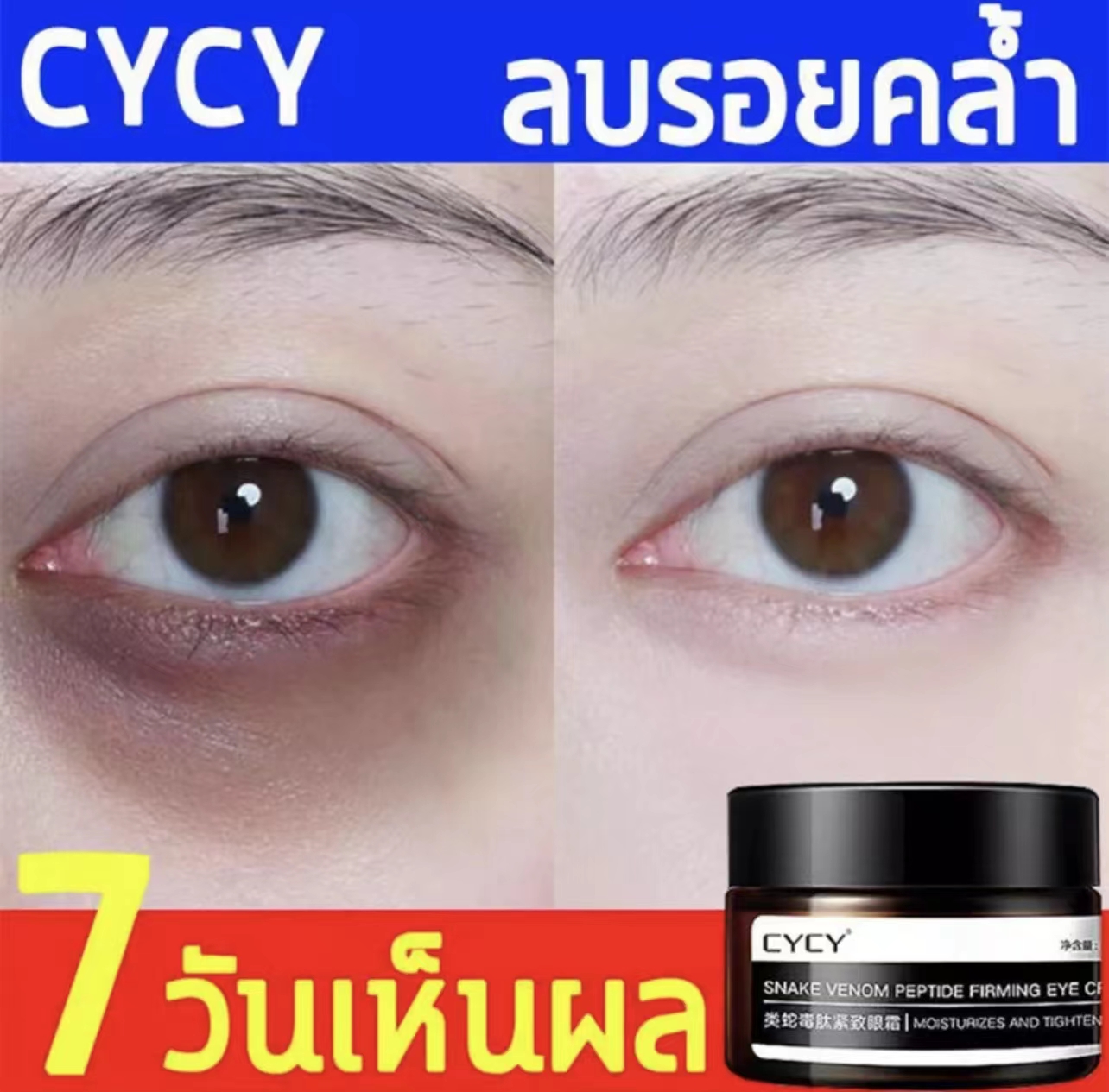 CYCY เปปไทด์พิษงู อายครีม30g สูตรพิเศษ เปปไทด์พิษงูครีมบำรุงรอบดวงตา ...