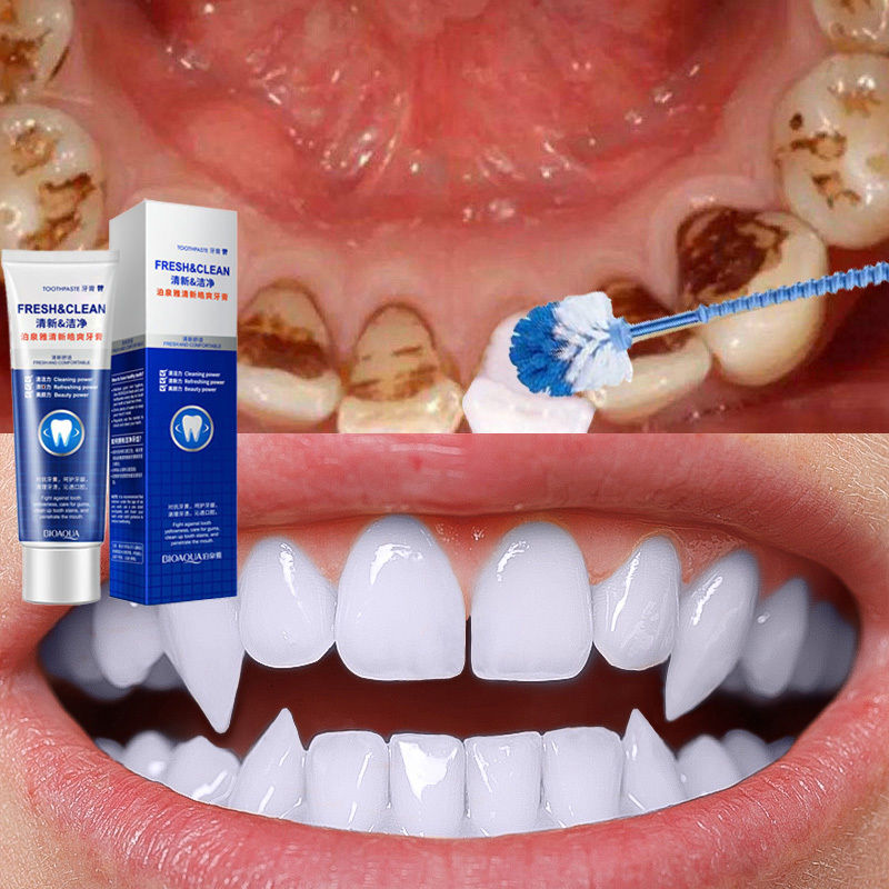 ฟอกฟันขาวยาสีฟันฟันขาวยาสีฟันสมุนไพร120g แก้ฟันเหลืองขัดคราบเหลืองคราบพฟันคราบชากาแฟแก้ก ขจัดกลิ่นปาก เหมาะสำหรับทุกคน
